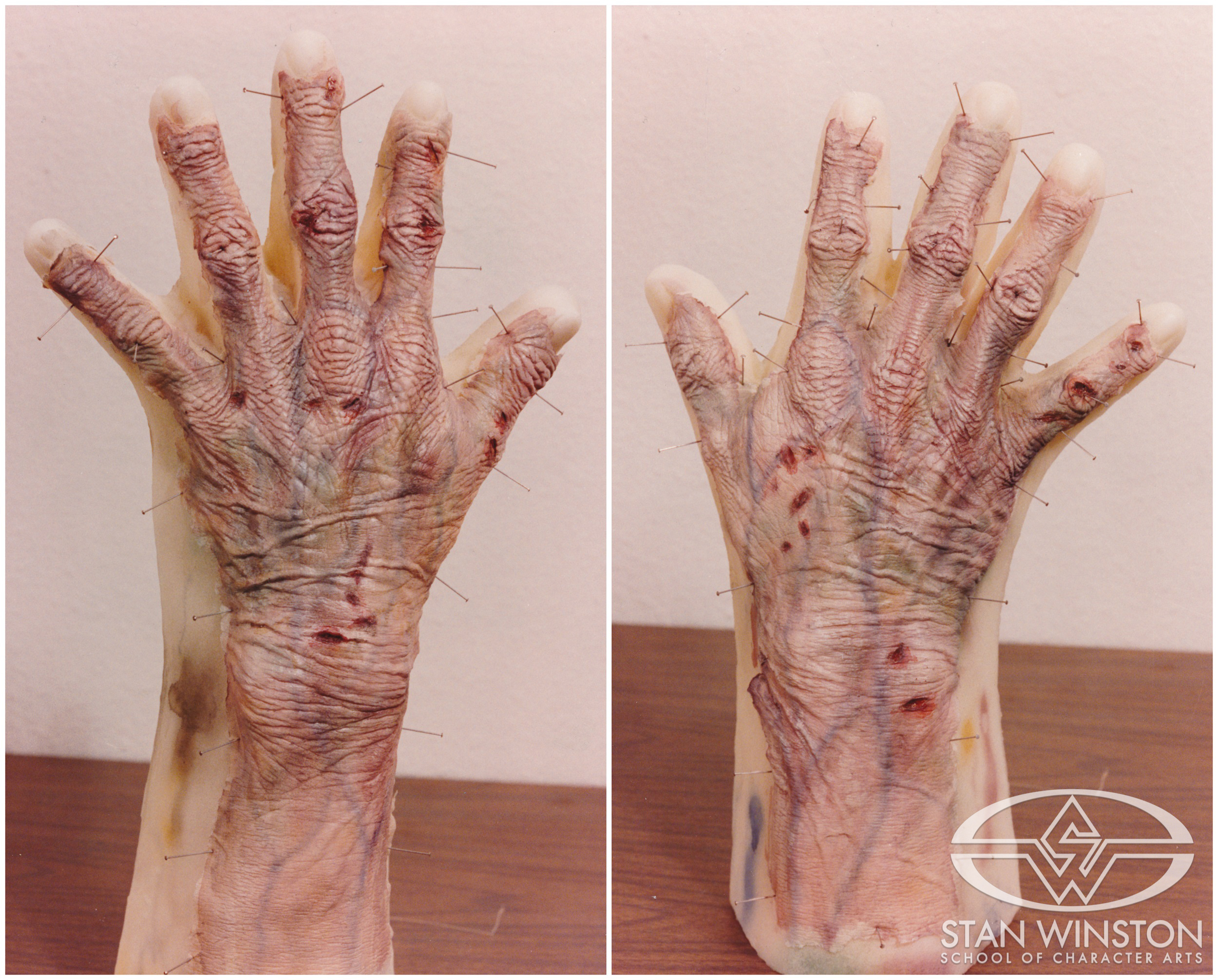 The Lestat decayed hand prosthetics.