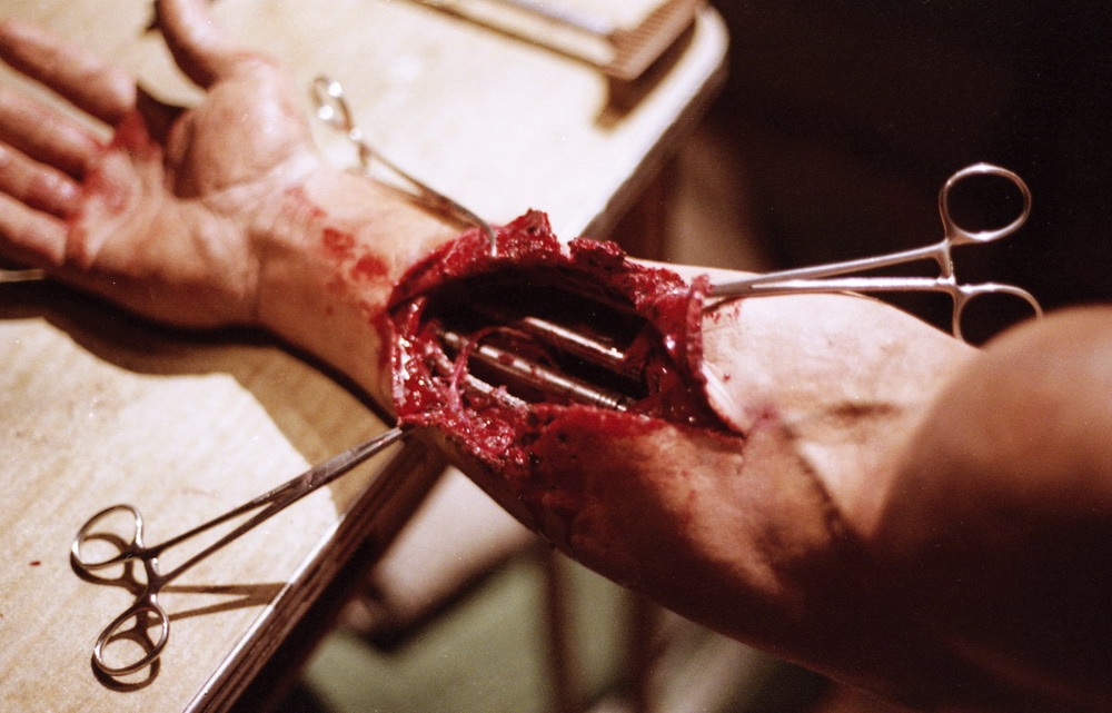 The prosthetic arm, made from a cast of Arnold Schwarzenegger’s arm, with the interior hollowed out to fit puppeteered mechanisms inside.&nbsp;Image courtesy of Hemdale Film, Pacific Western Productions, Euro Film Funding, and Cinema '84.