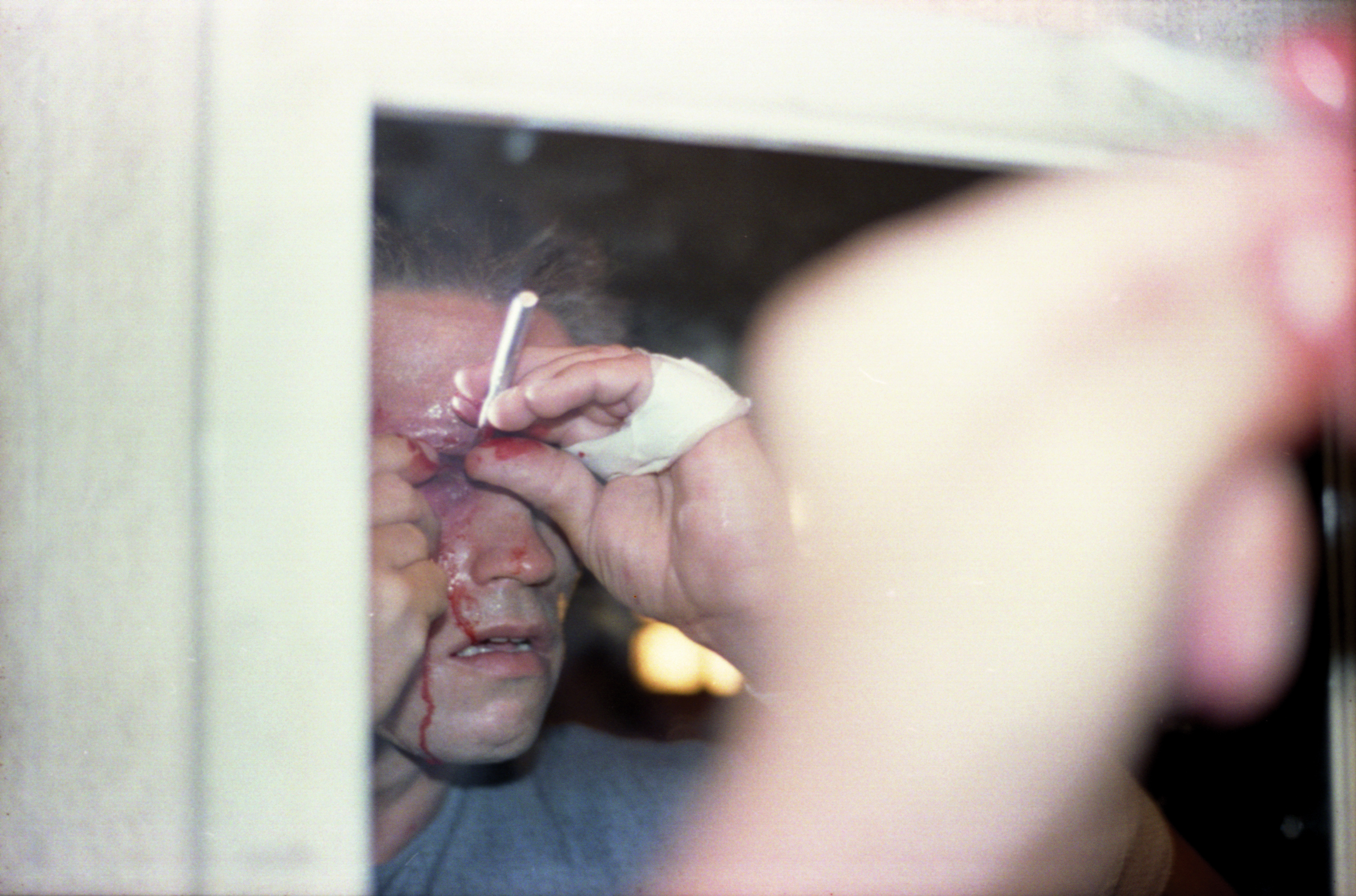 On set of Arnold&nbsp;Schwarzenegger practicing the eye-surgery scene.&nbsp;Image courtesy of Hemdale Film, Pacific Western Productions, Euro Film Funding, and Cinema '84.